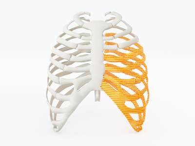 3d printed rib cage. 3d printed implants on white background. 3d illustration.